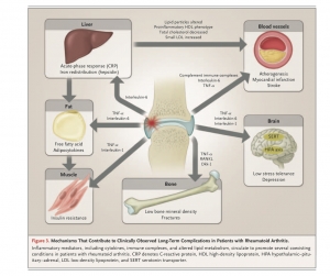 Evolu&ccedil;&atilde;o da Artrite Reumat&oacute;ide